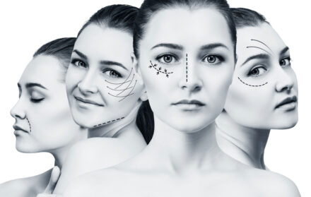 facelifts